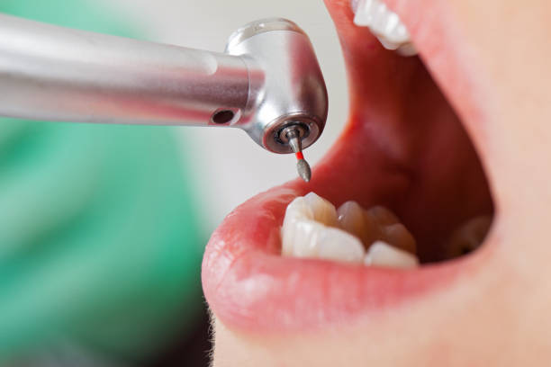 Best Knocked-Out Tooth Emergency  in Highwood, IL